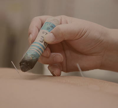 Прижигание