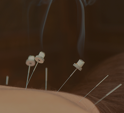 Моксотерапия