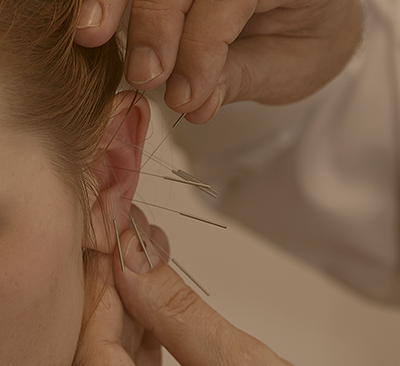 Аурикулотерапия