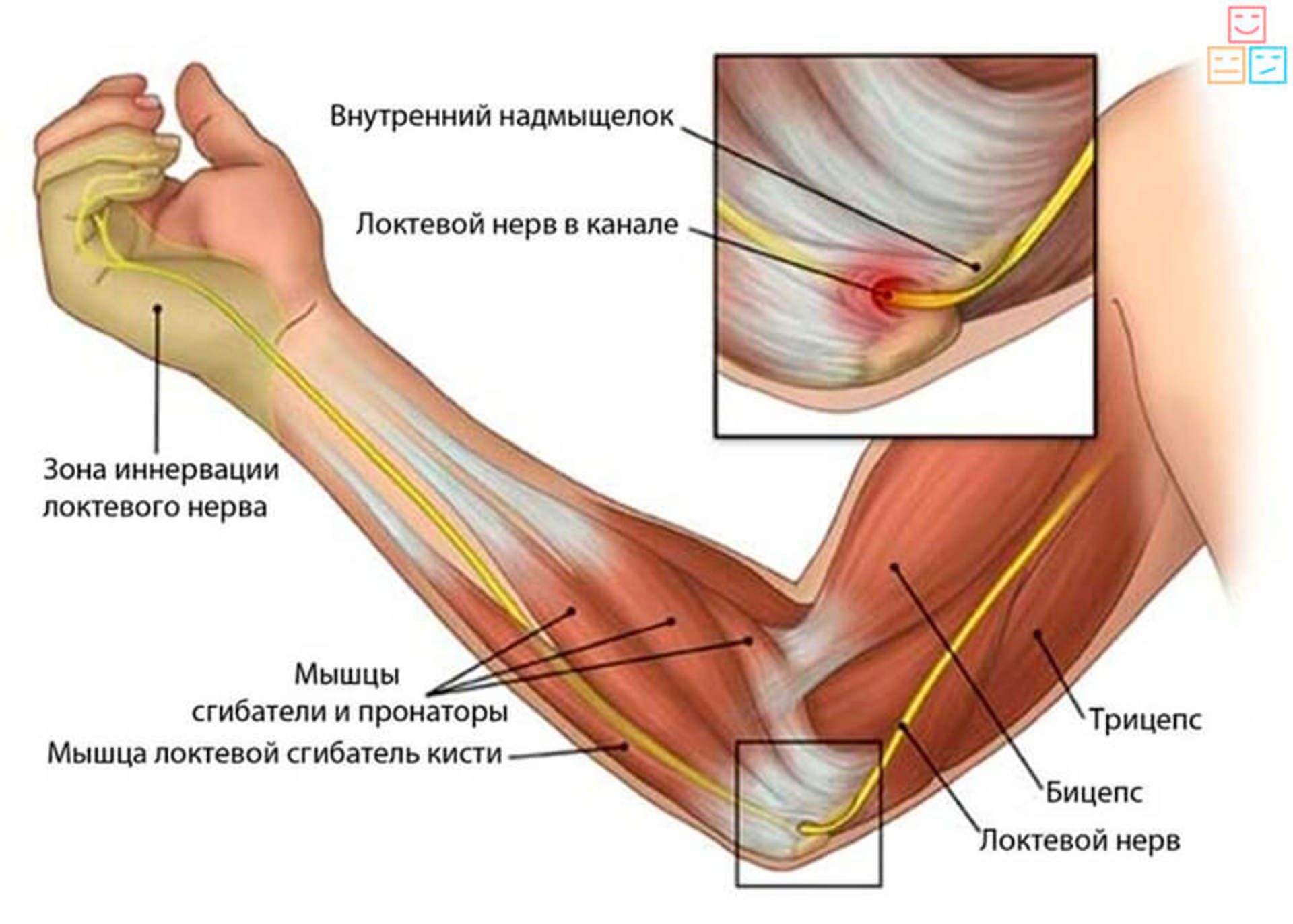 Локтевой сустав анатомия локтевой нерв. Связки и сухожилия локтевого сустава. Латеральный эпикондилит. Кубитальный туннельный синдром локтевого нерва. Можно лечить ли руку