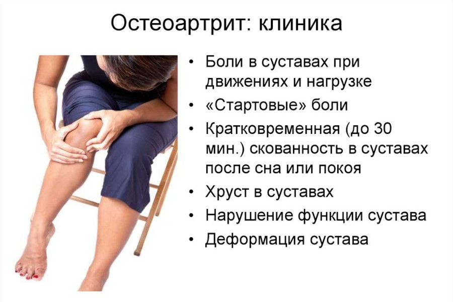 Симптомы остеоартрита
