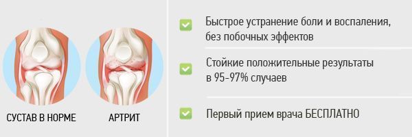 лечение полиартрита суставов Лечение полиартрита