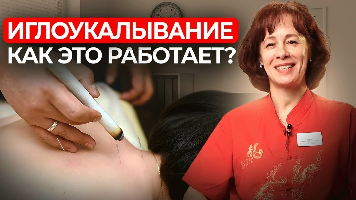 Что лечит ИГЛОУКАЛЫВАНИЕ? И как оно работает?