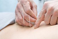 Акупунктура – эффективный метод лечения тугоухости