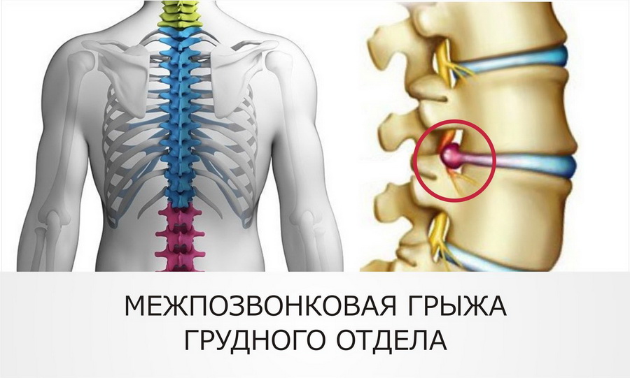 Характерные симптомы