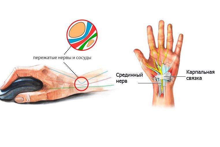 osteopaty-tunel-4.jpg