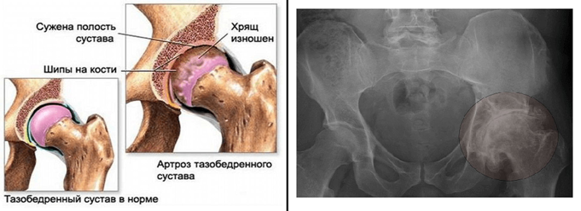 Лечение в клинике «Тибет»