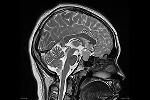 МРТ головного мозга в клинике Тибет