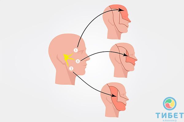 Чем лицевая невралгия отличается от неврита?